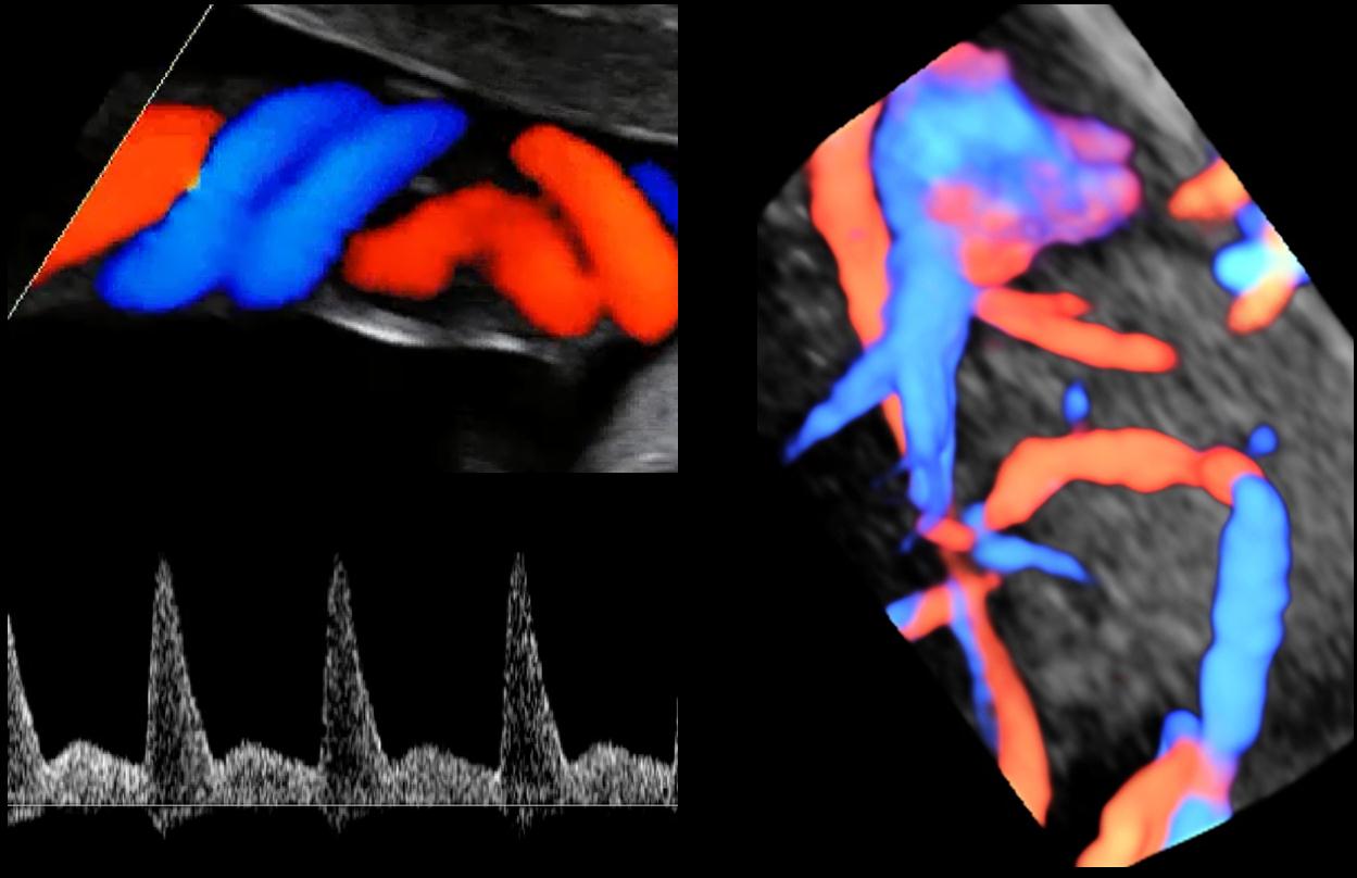 Ultrasound in Obstetrics & Gynecology